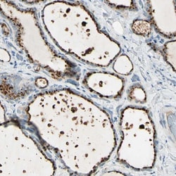 Angiopoietin-like Protein 1/ANGPTL1 Antibody, Novus Biologicals 0.1mL;